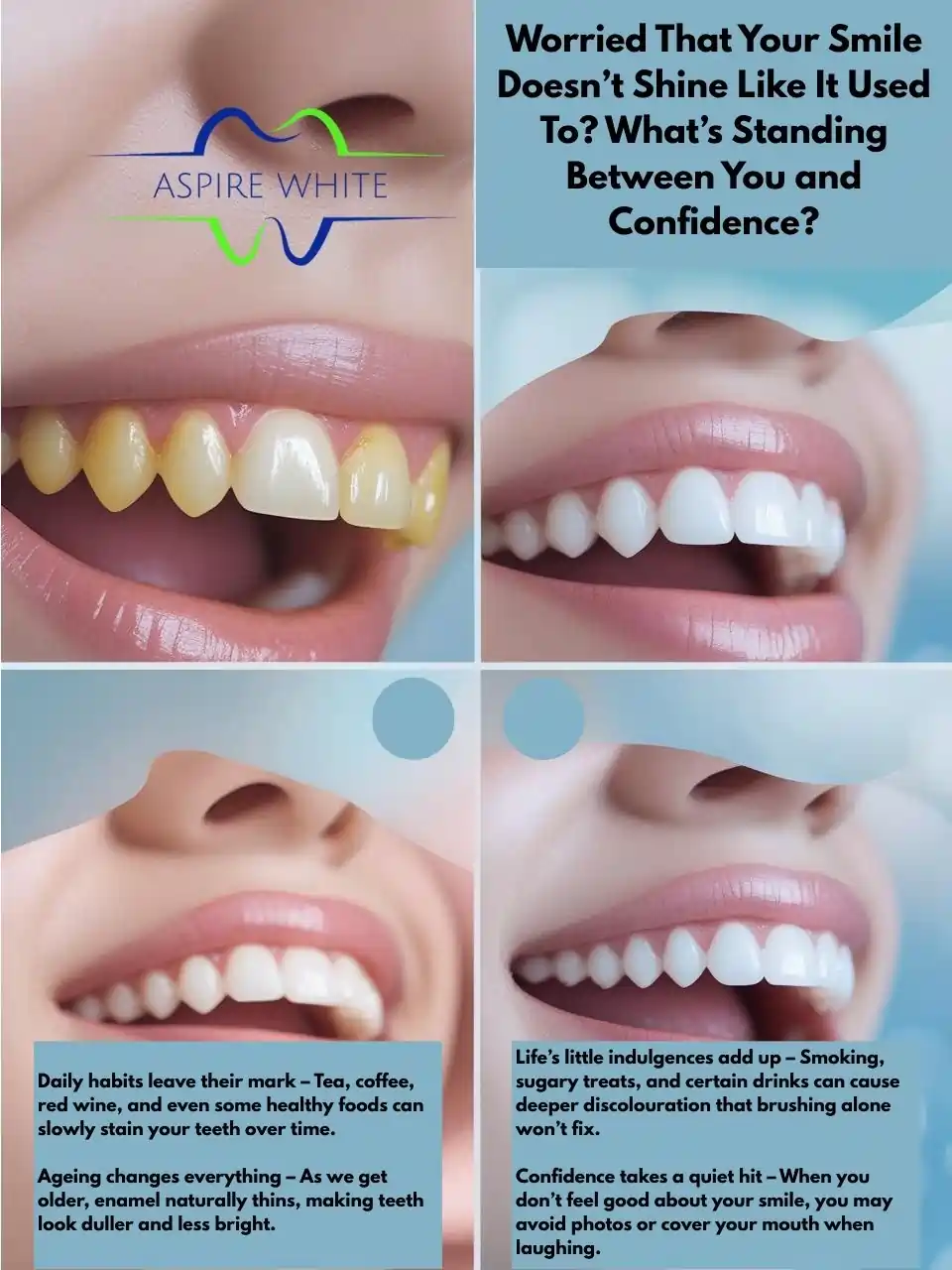 Worried That Your Smile Doesn’t Shine Like It Used To What’s Standing Between You and Confidence Plymouth